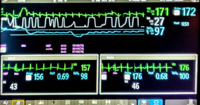 アメリカでNICU（新生児集中治療室）に入ったことによる予想外のメリット